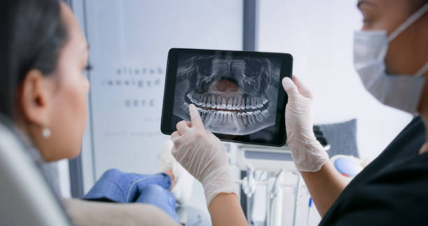 Licensed Dental Implants service in Lafayette, CA - Smile Center Dentistry