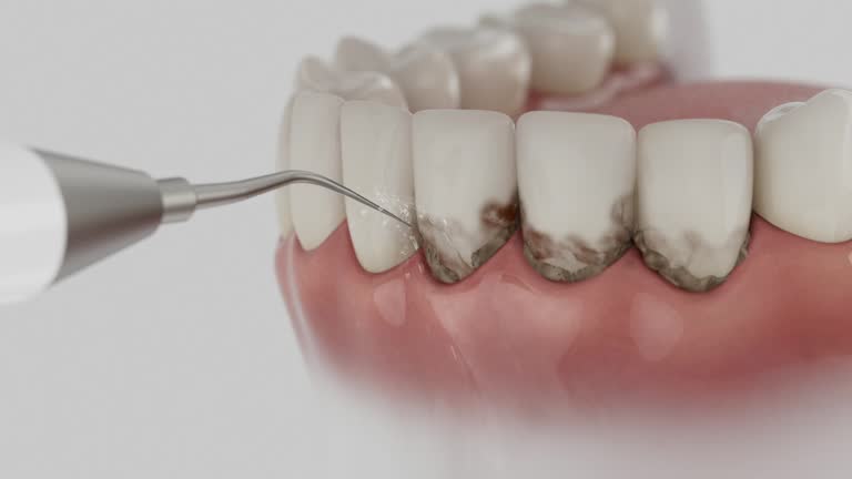 Reliable Dental Implants contractor in Lafayette, CA by Smile Center Dentistry